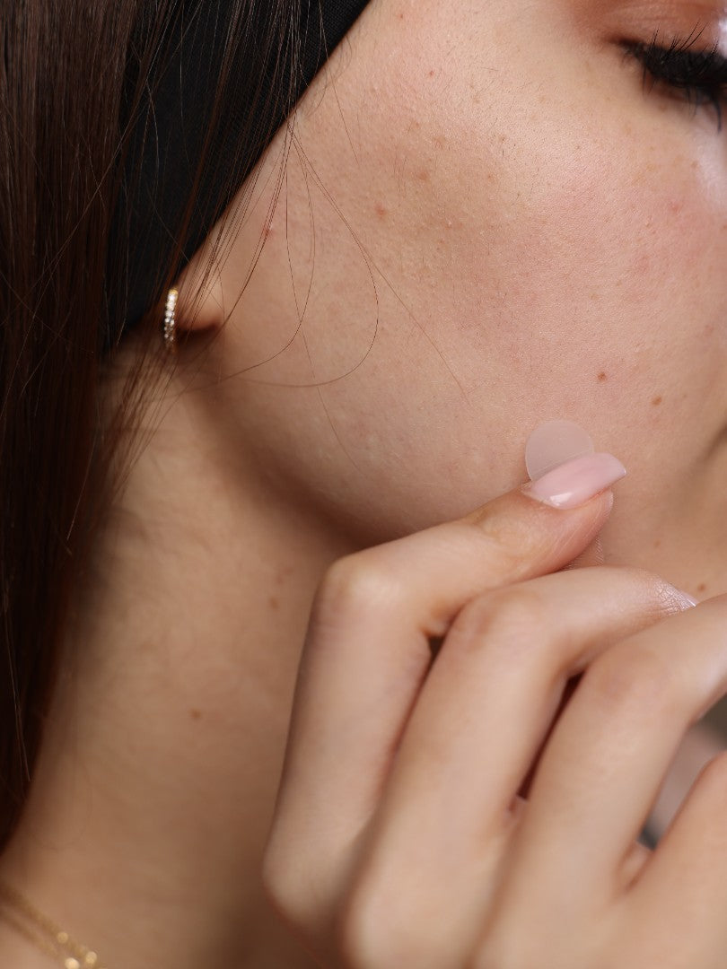 nua's premium pimple patches